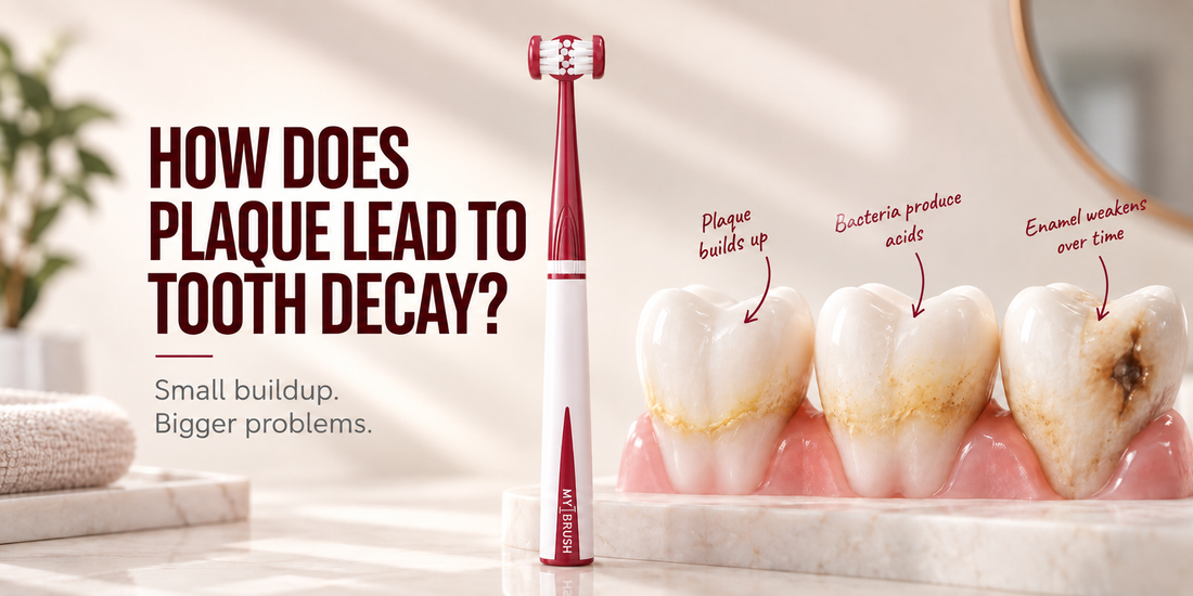 How Does Plaque Cause Tooth Decay?