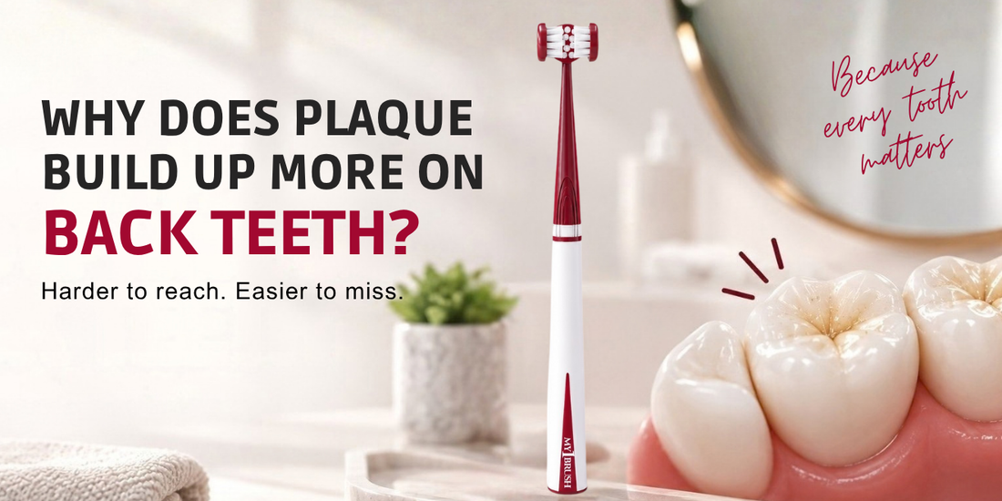 Where Does Plaque Build Up Most on Your Teeth?