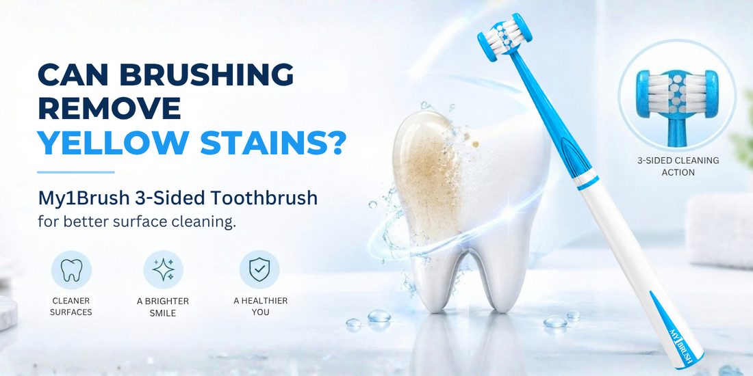 Can Brushing Remove Yellow Stains From Teeth?