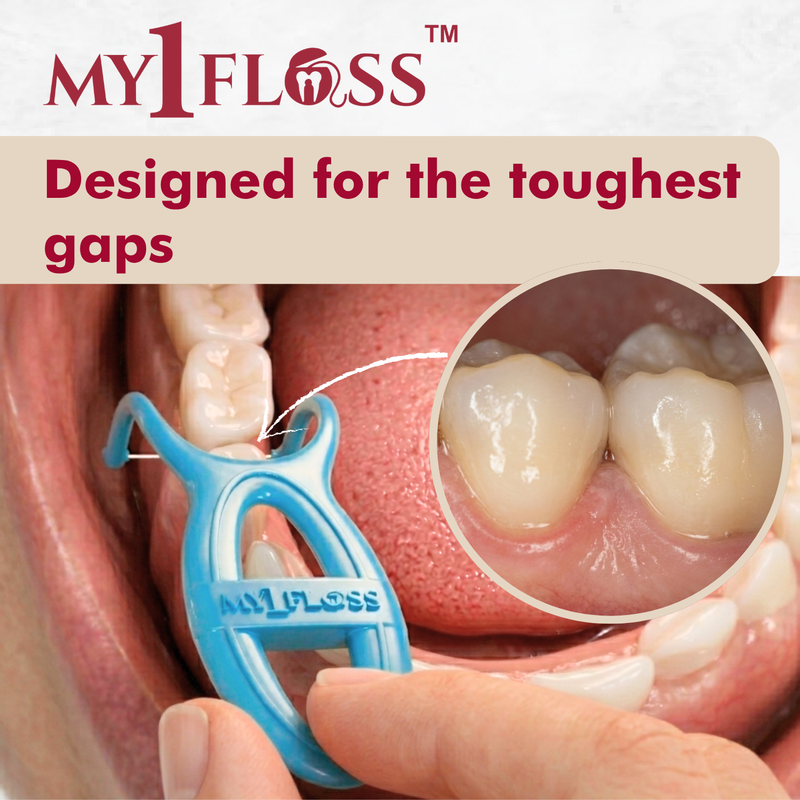 My1Floss - Instant Dental Floss (Pack of 5)